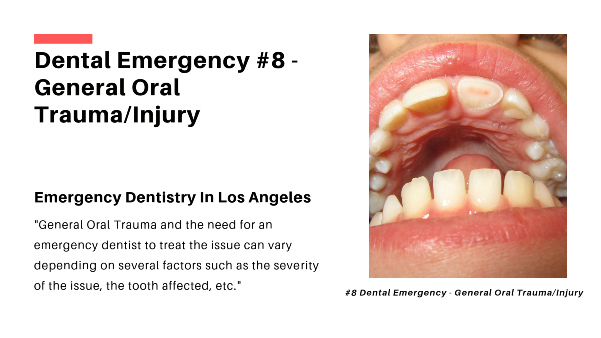 Emergency Dentistry General Oral Trauma