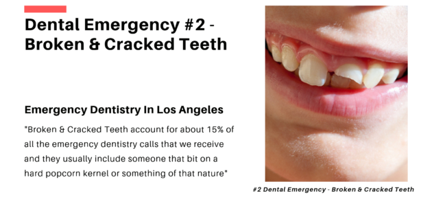 Broken Teeth Dental Emergency Calls