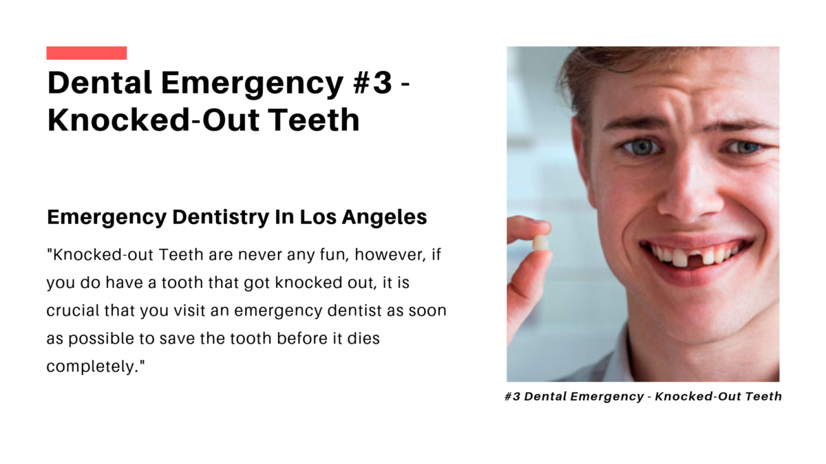 Knocked Out Tooth Dental Emergency